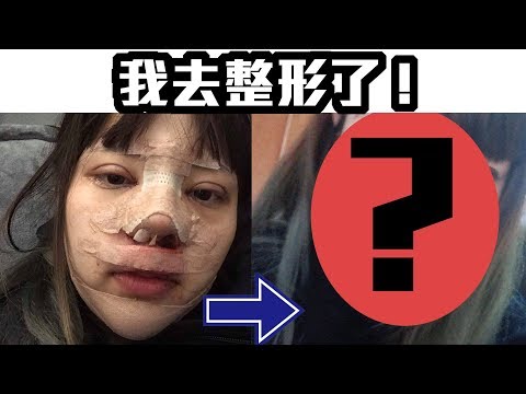 【直白小劇場38-我去整形了！】手術過程大公開/左營李毓芬？